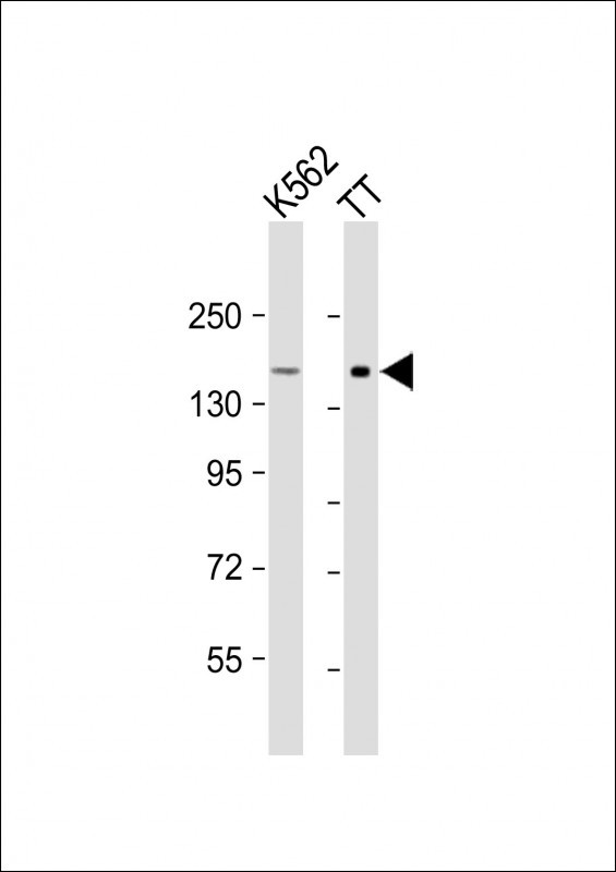 WB - c-KIT Antibody (C-term) AP7656b